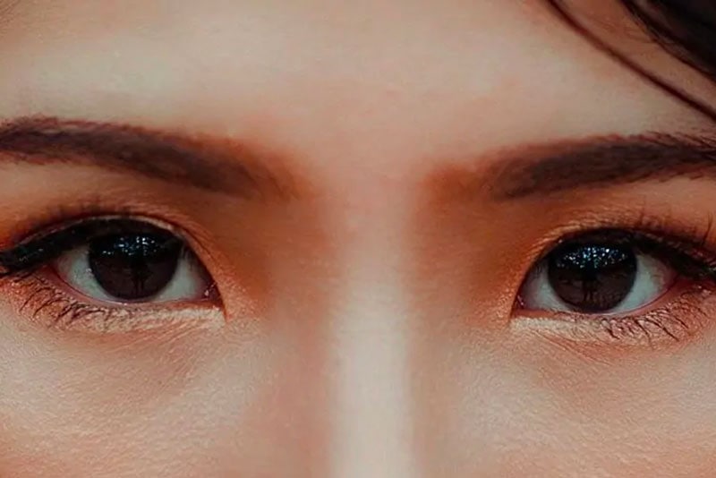 Dry Eyes After LASIK? Is This Normal?