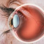 retina mata