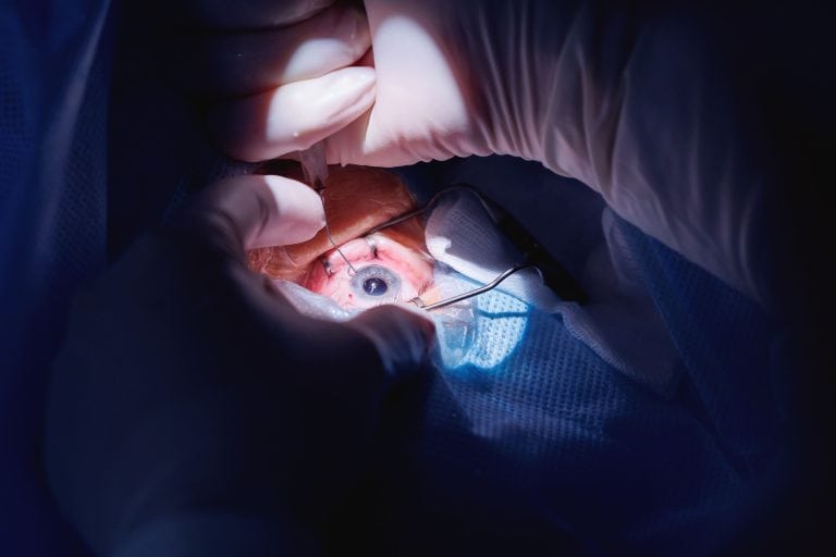 Persamaan Lasik Mata dan Operasi Katarak, Jangan Keliru!