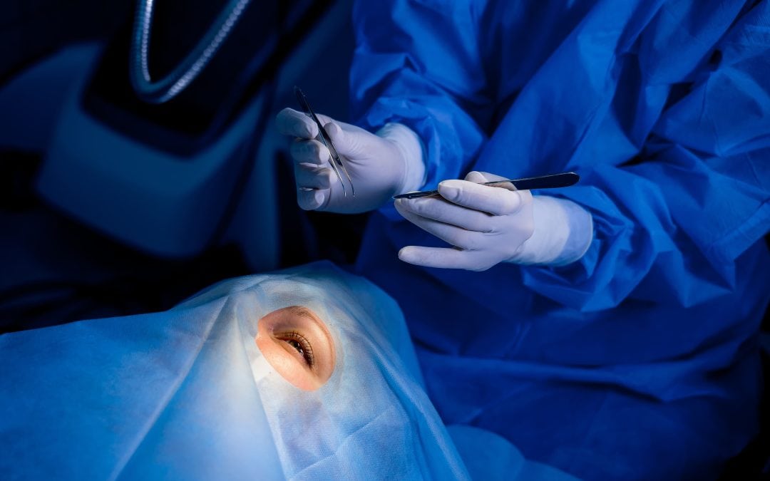 Cataract Surgery